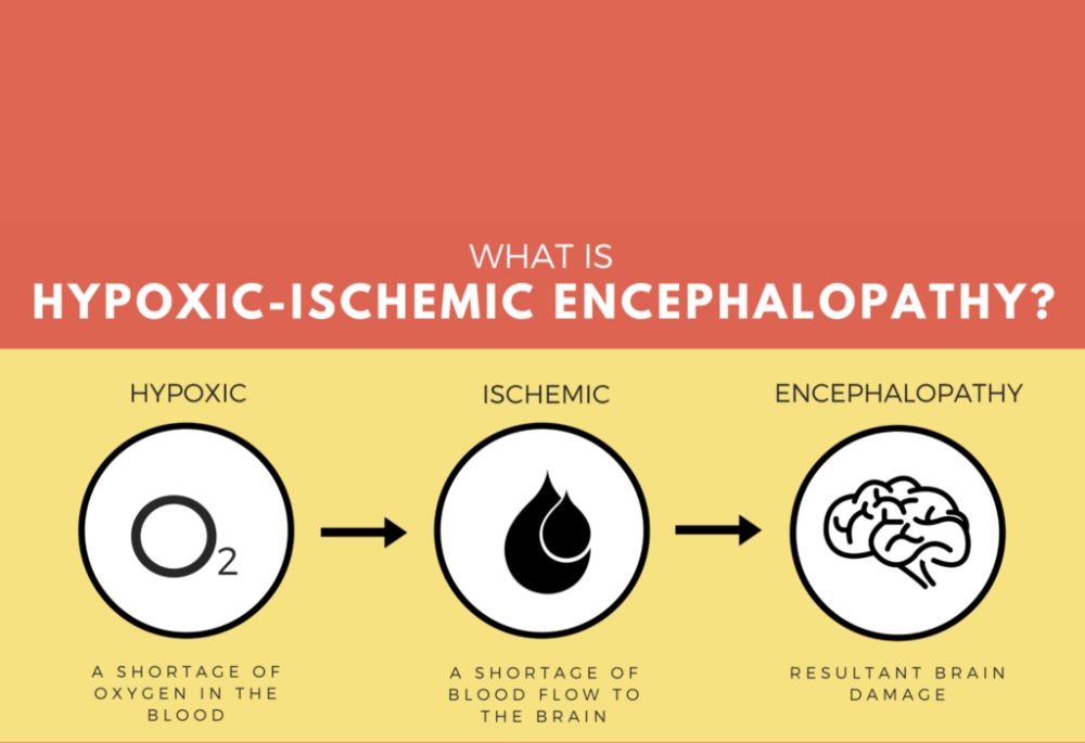 What are the Factors that Lead to Hypoxic-Ischemic Encephalopathy - Featured Image