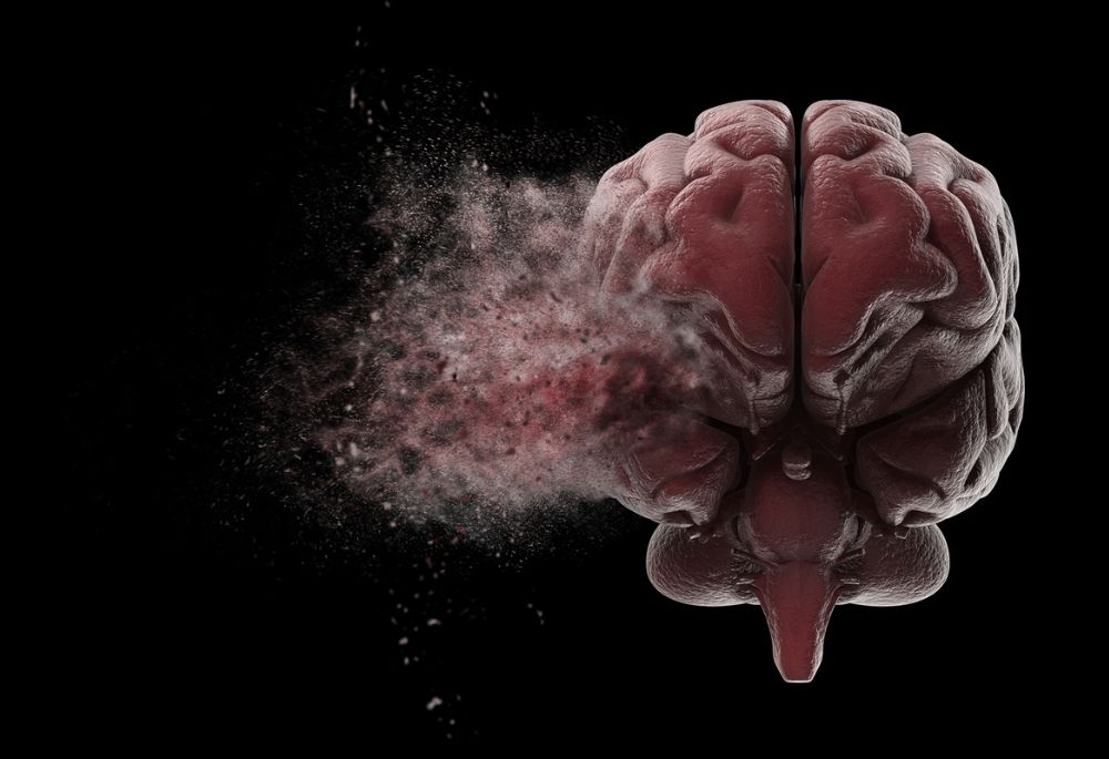 What Expenses Are Associated with Traumatic Brain Injuries? - Featured Image