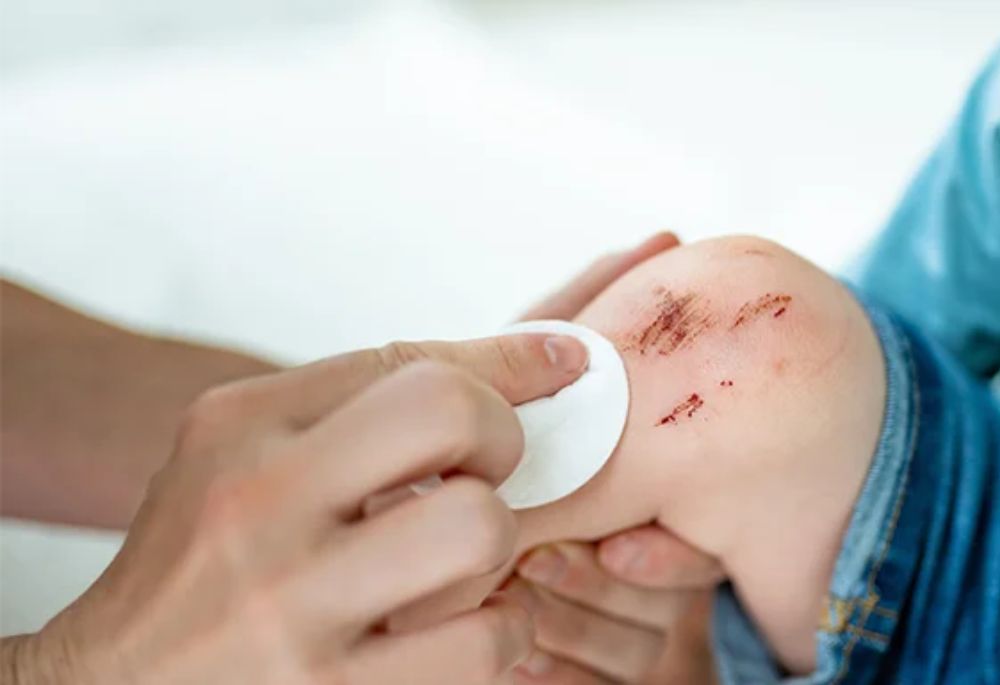 How Do Lawsuits for Injuries to Children Work? - Featured Image
