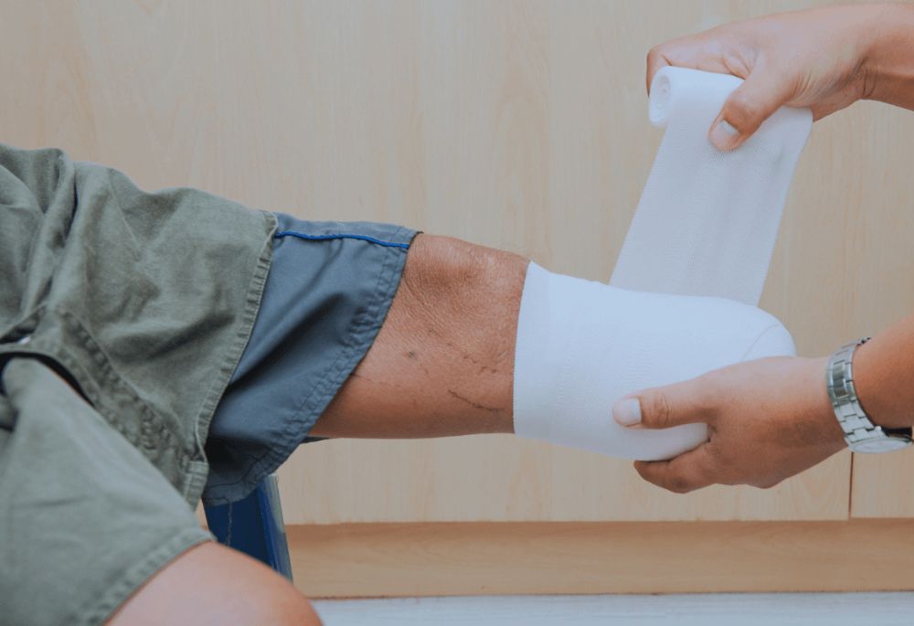 Leg being bandaged after amputation