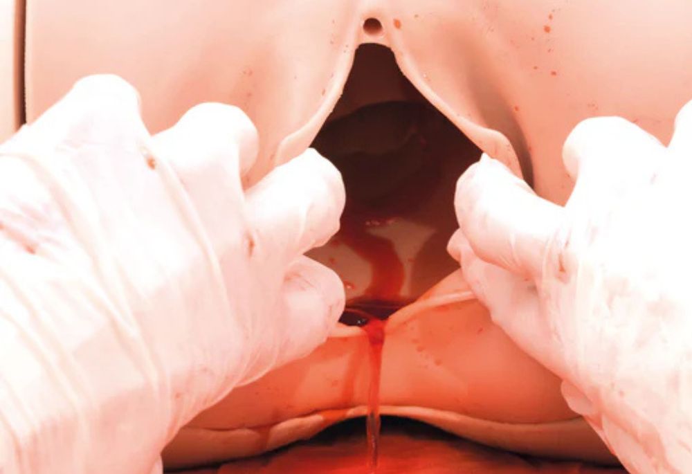 Can I Sue for Postpartum Hemorrhage? - Featured Image