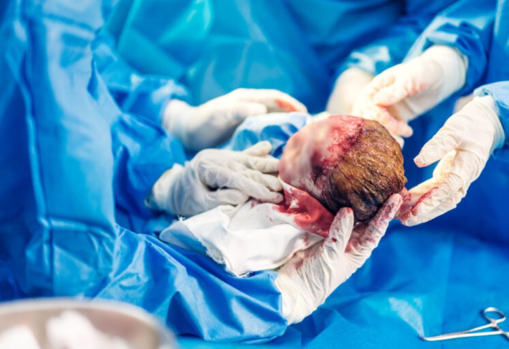 Birth Injury Statistics – Understanding the Impact with Wagner Reese, LLP