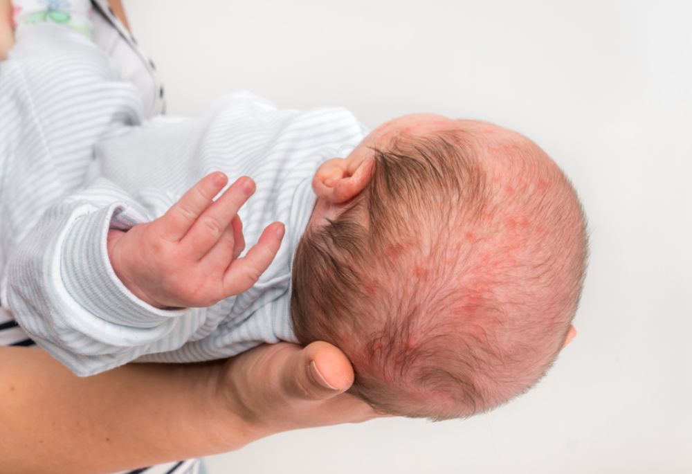 Can a Birth Injury Occur After Birth?