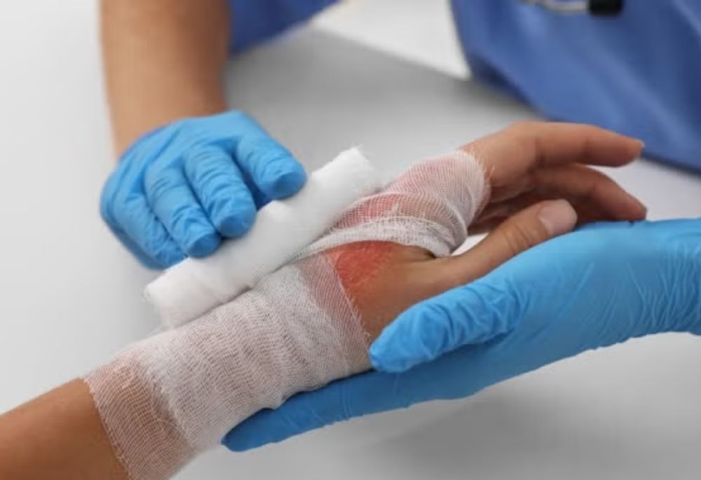 Hand with burn injuries in hospital care