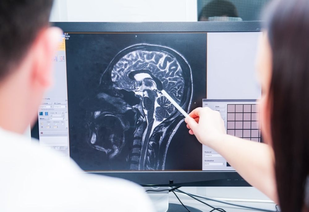 How to File a Brain Injury Lawsuit on Behalf of a Family Member