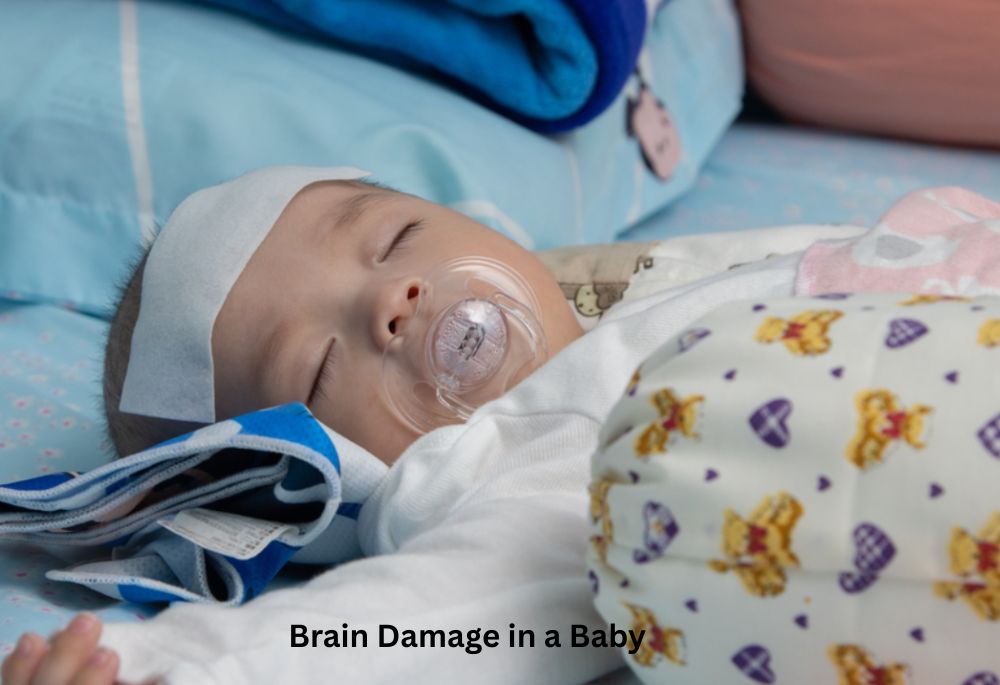 What Are the Early Signs of Brain Damage in a Baby? - Featured Image