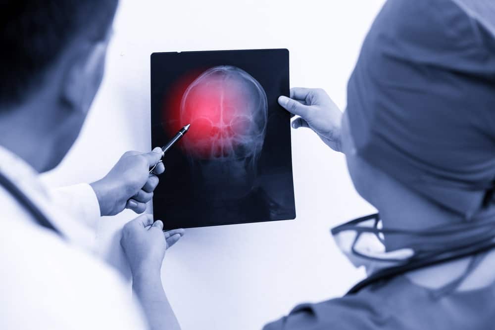 Doctors Looking At An Xray Of A Human Head