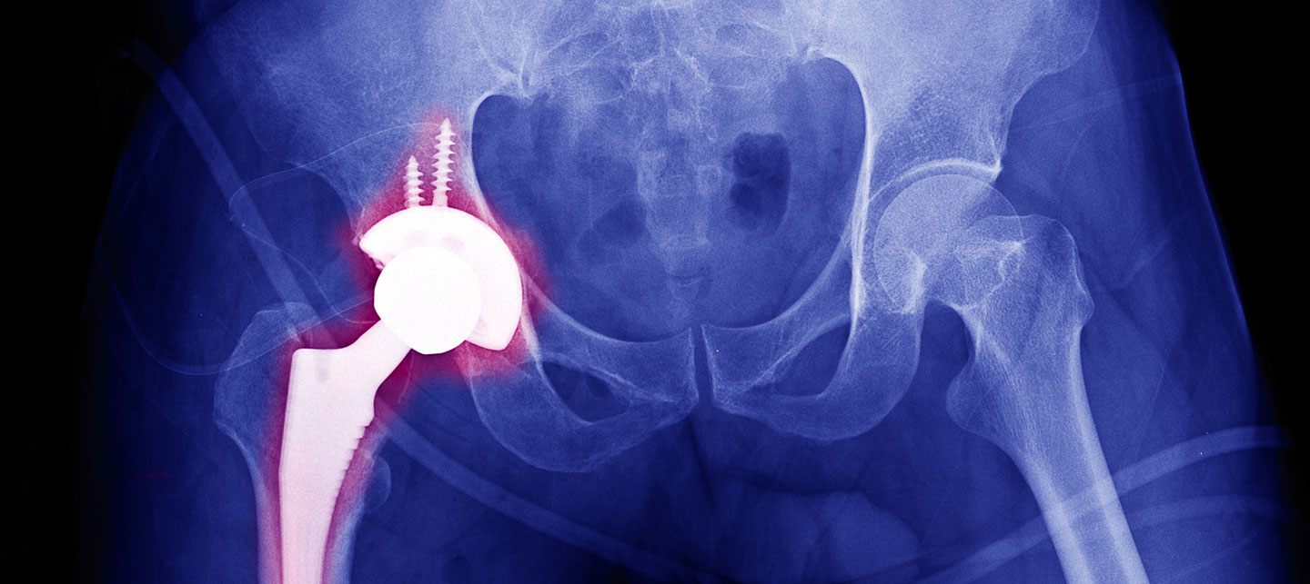 Defective Drugs & Medical Devices